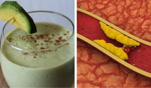 Awokado na obniżenie cholesterolu - wypróbuj te koktajle