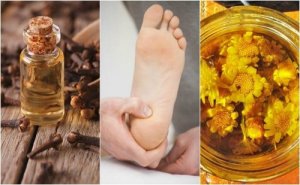 Ból pięty czyli talalgia - 6 naturalnych remediów