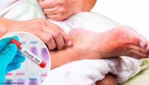 Kwas moczowy – 5 powodów jego nadmiaru