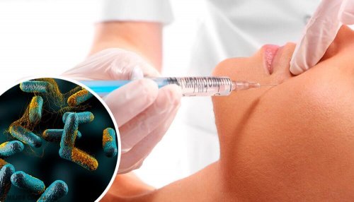 Jad kiełbasiany - zabójcza trucizna