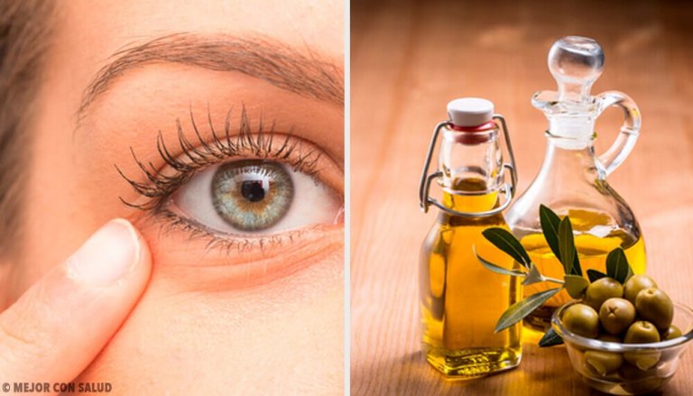 Zapalenie oczu - 6 naturalnych remediów