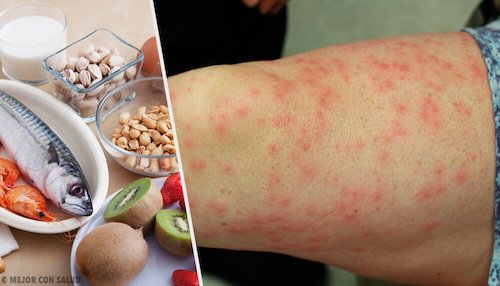 Produkty wywołujące alergie pokarmowe i ich substytuty