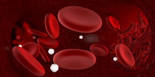 Anemia – skuteczne domowe środki na tę chorobę