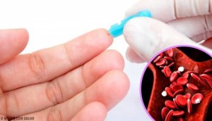 Poziom hemoglobiny i żywność, która o niego zadba!