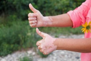 Protokół autoimmunologiczny - dieta w walce z chorobą