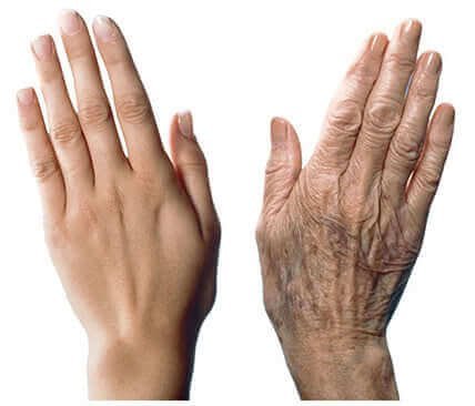 Skóra dłoni – jak chronić ją przed starzeniem?