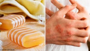 Egzema - przepis na naturalne mydło lecznicze