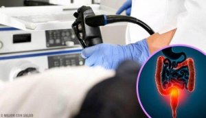 Rak jelita – dowiedz się jakie są objawy i leczenie