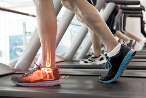 graviola na zdrowe stawy, osoba trenuje na bieżni sport