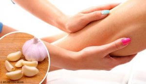 Obrzęki: poznaj naturalne metody leczenia