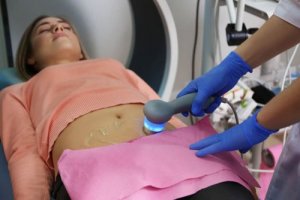 Zespół policystycznych jajników – 5 objawów