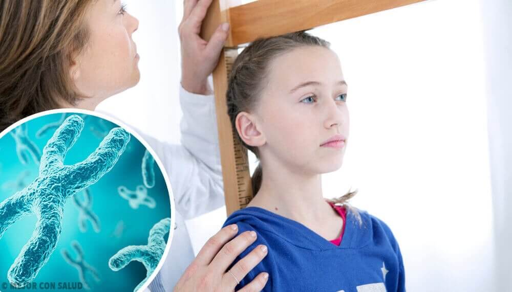 Dziewczyna cierpiąca na zespół Turnera