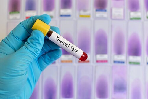 Badanie krwi na T4 i TSH
