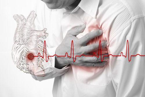 Elektrokardiogram pomaga zdiagnozować arytmię serca.