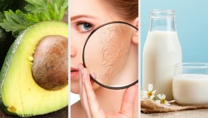 Sucha skóra – 10 domowych produktów nawilżających