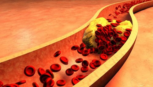 Naczynia krwionośne – oczyść je mozgą kanaryjską