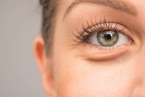 Opuchlizna oczu – 7 możliwych przyczyn