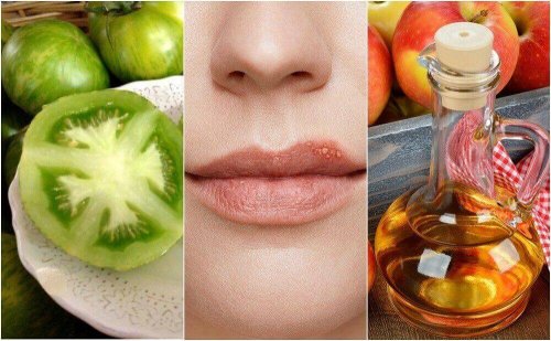 Opryszczka – zwalcz ją 5 naturalnymi sposobami Opryszczka – zwalcz ją 5 naturalnymi sposobami