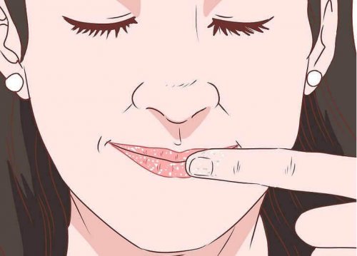 Popękane usta – 6 sposobów zapobiegania