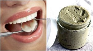 Próchnica – zwalcz ją w 100% naturalnym remedium
