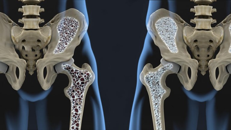 Profilaktyka osteoporozy – 2 koktajle bogate w wapń