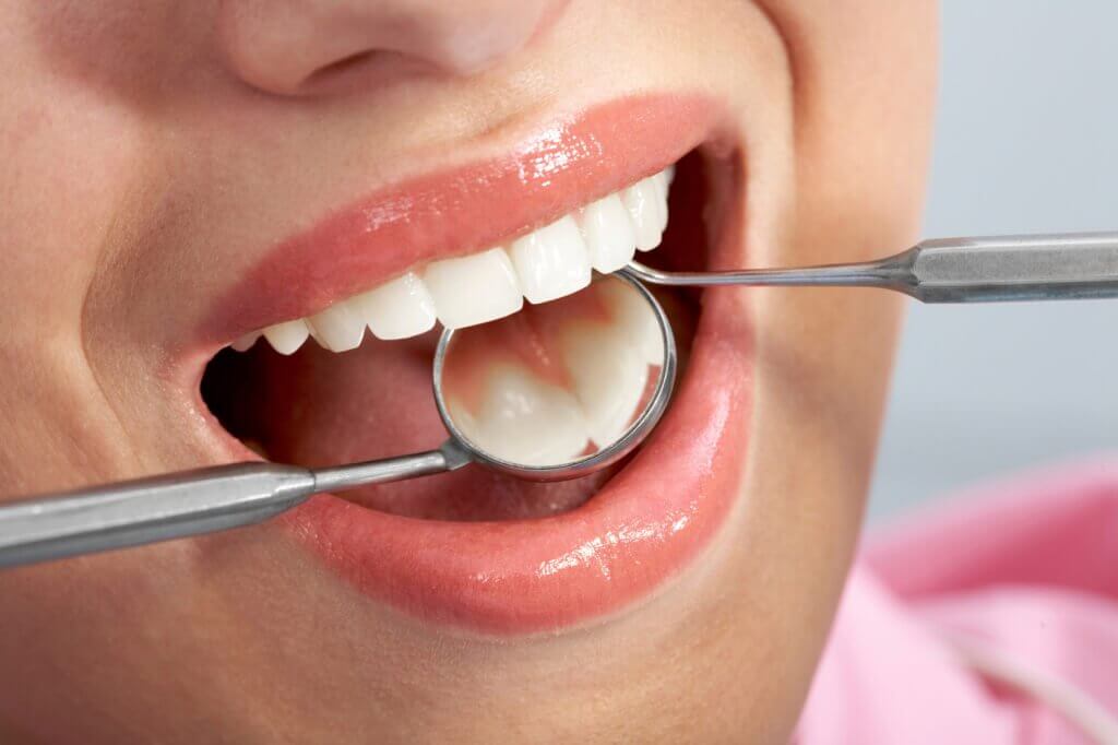 Kontrola zębów u dentysty