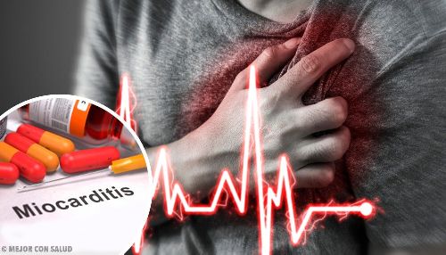 Zapalenie mięśnia sercowego – objawy i leczenie