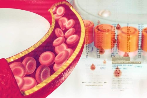 Niewydolność żylna