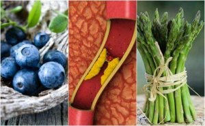 Miażdżyca tętnic – 7 zalecanych produktów