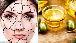 Sucha skóra - naturalne sposoby na jej ukojenie