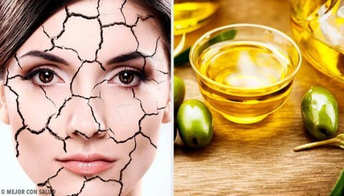 Sucha skóra – naturalne sposoby na jej ukojenie