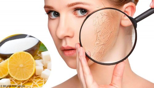 Sucha skóra – środki złuszczające do tego typu cery
