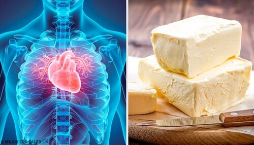 Żywność szkodliwa dla serca - unikaj tych 5 produktów