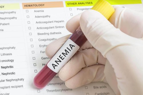anemia z niedoboru żelaza