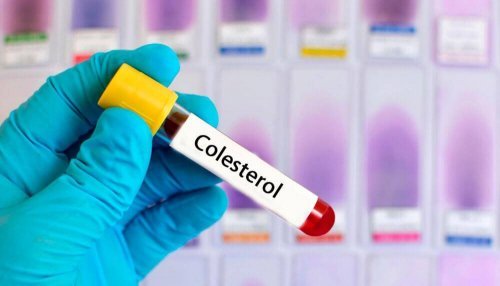 Podwyższony cholesterol – 6 naturalnych remediów