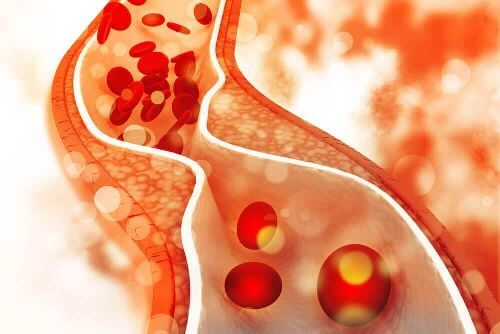Cholesterol na ścianach naczyń krwionośnych