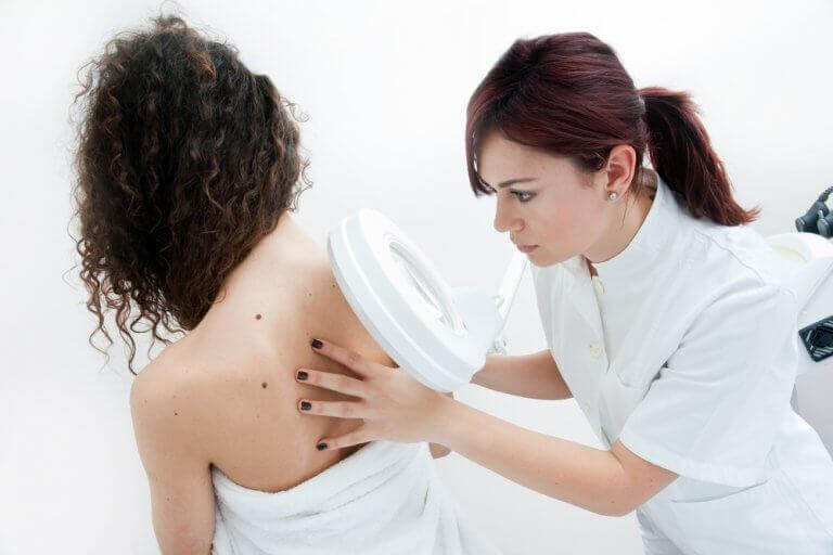 Dermatolog bada nietypowy pieprzyk na plecach