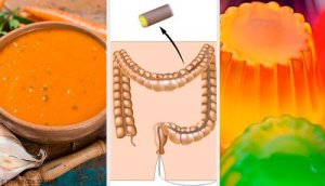 Kolonoskopia - dieta i przygotowania