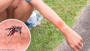 Ukąszenie przez komara: co się wtedy dzieje?