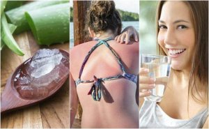 Oparzenia słoneczne - 9 sposobów ich leczenia