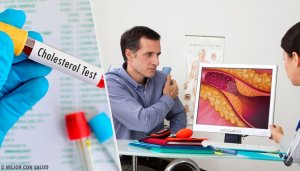 Poziom cholesterolu - kiedy powinieneś zacząć się nim martwić?