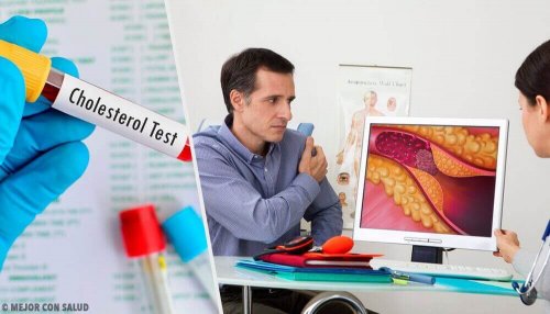 Poziom cholesterolu - kiedy powinieneś zacząć się nim martwić?