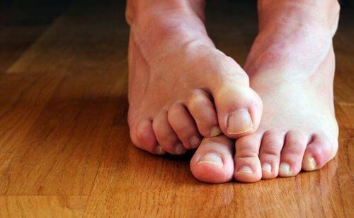 Bose stopy z grzybicą