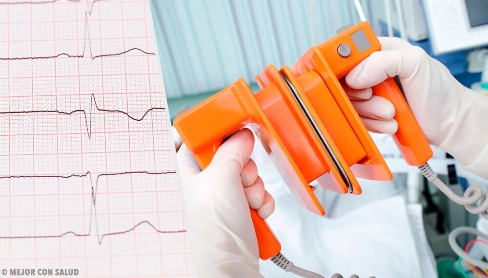Desfibrylator i krzywa EKG