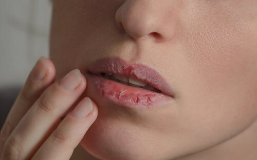 Suchość w ustach – 5 leków, które ją łagodzą
