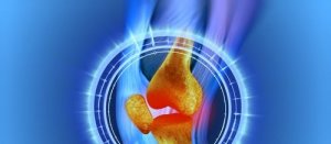 Operacja łąkotki - jak szybko odzyskać sprawność?