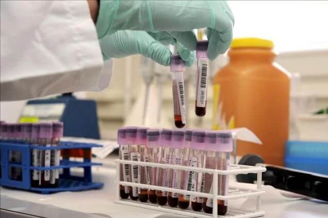 Badania laboratoryjne - przeszczep komórek macierzystych