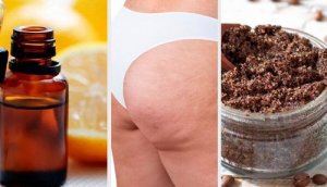 Cellulit: naturalne przepisy i sposoby na jego redukcję