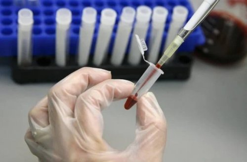 Przeszczep komórek macierzystych lekiem na HIV!