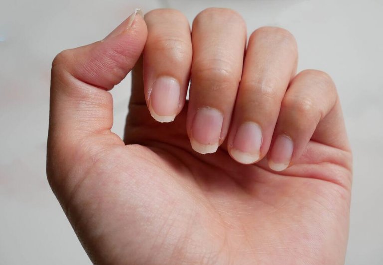 Łamliwe paznokcie - 8 naturalnych remediów